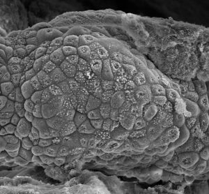 Ovarian cancer cells forming a cancer spheroid as they grow within the peptide-protein co-assembling material [Credit: Alvaro Mata].
