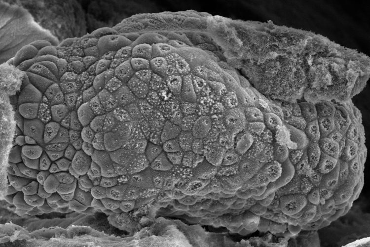 Ovarian cancer cells forming a cancer spheroid as they grow within the peptide-protein co-assembling material [Credit: Alvaro Mata].