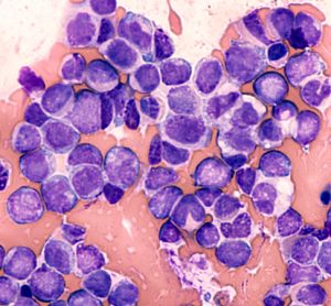 p53 cancer cell death