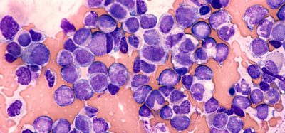 p53 cancer cell death
