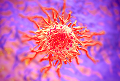 pancreatic cancer cell