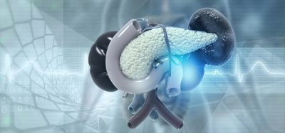 pancreatic cancer