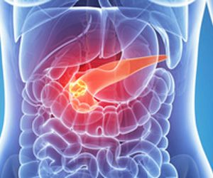 pancreatic cancer