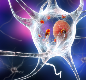 New evidence sheds light on how Parkinson’s disease may happen