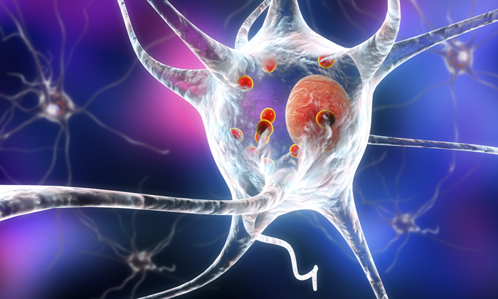 New evidence sheds light on how Parkinson’s disease may happen