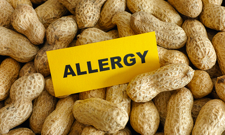 nanoparticles peanut allergy