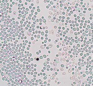 protein abundance in yeast cell