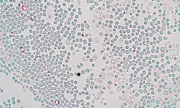 protein abundance in yeast cell