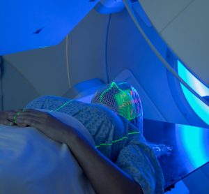 woman undergoing radiation for brain cancer
