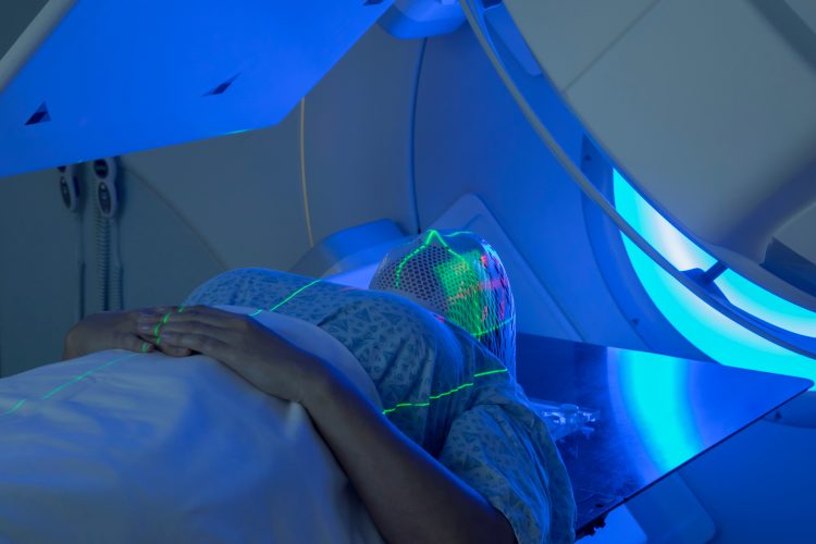 woman undergoing radiation for brain cancer