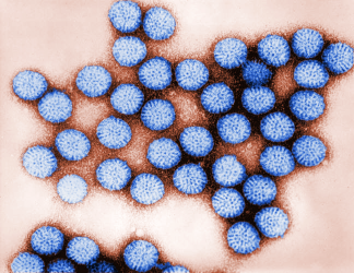 rotavirus particles coloured blue