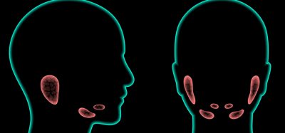 Salivary gland in human mouth. Parotid, submandibular, and sublingual glands. Produce of saliva through a system of ducts. Xerostomia oral disease anatomical poster. Medical 3d vector illustration.