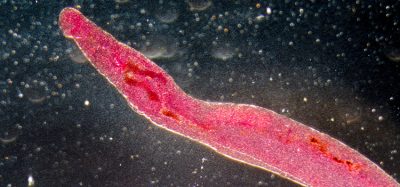 Medical,Microscopy,Animal,Parasiteras,Schistosome,Blood,Flukes