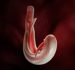 Schistosomiasis image