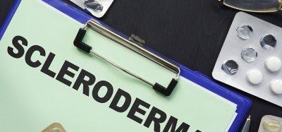 Conceptual photo showing printed text Scleroderma