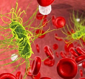 sepsis