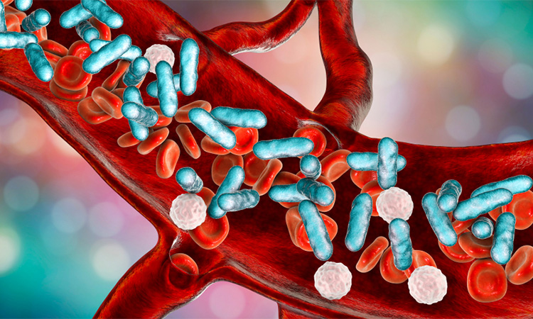 Sepsis bacteria in blood