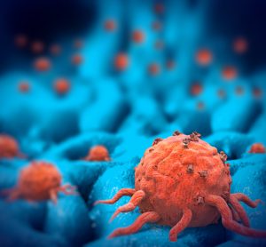 Orange cancer cells on blue background