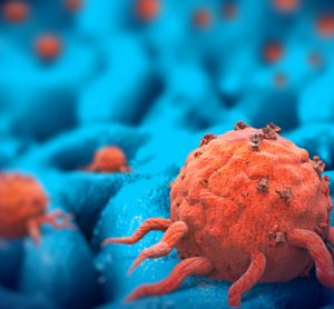 Cancer cells