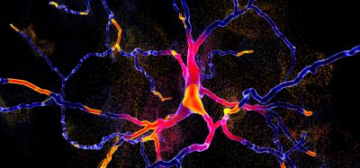 Degeneration of dopaminergic neuron, indicating onset of Parkinson's disease