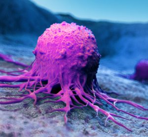 Metastising cancer cell