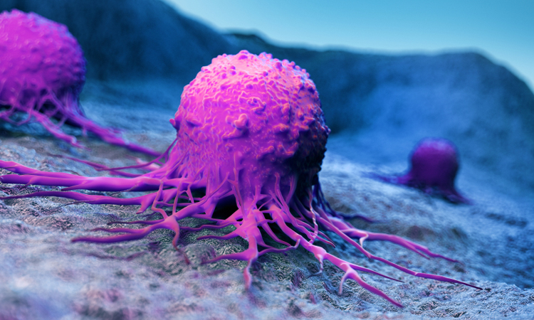 Metastising cancer cell