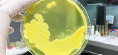 Staphylococcus Aureus grown in petri dish