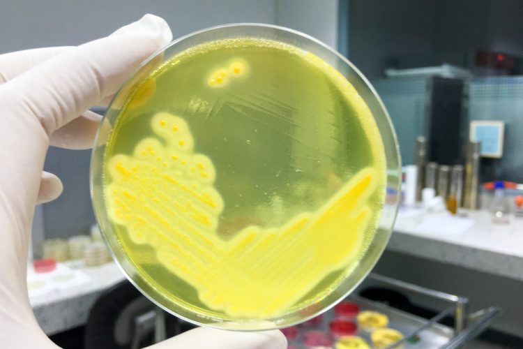 Staphylococcus Aureus grown in petri dish