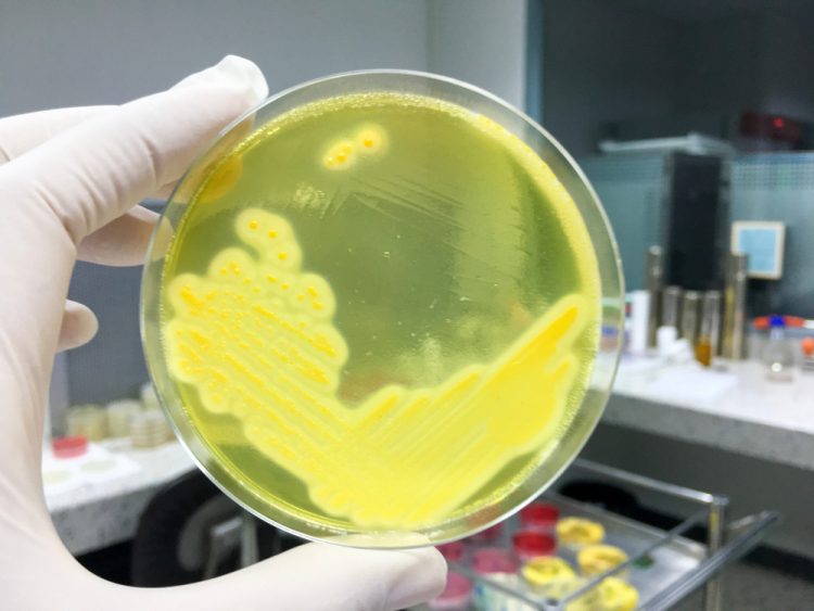 Staphylococcus Aureus grown in petri dish