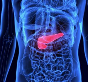 Pancreatic cancer