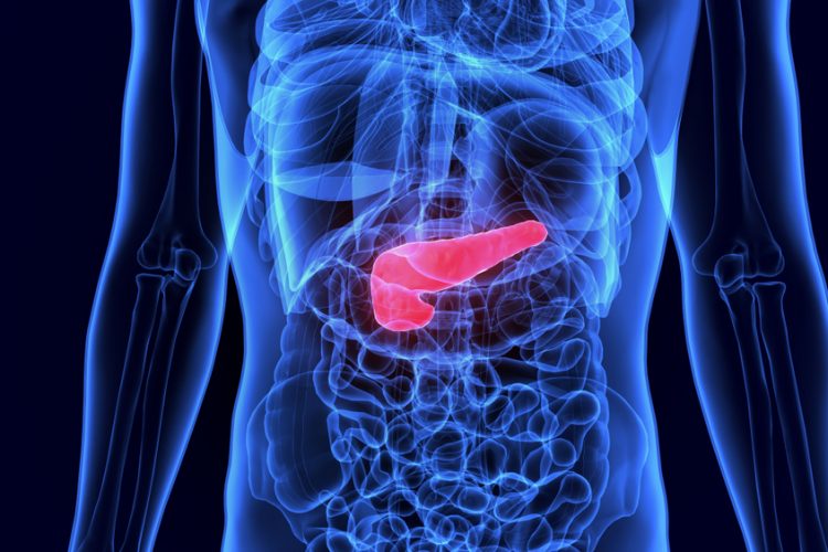 Pancreatic cancer