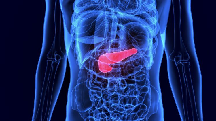 Pancreatic cancer