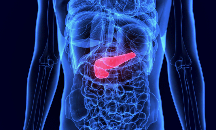 pancreatic cancer