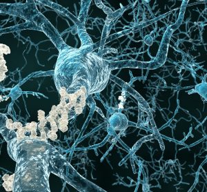 amyloid