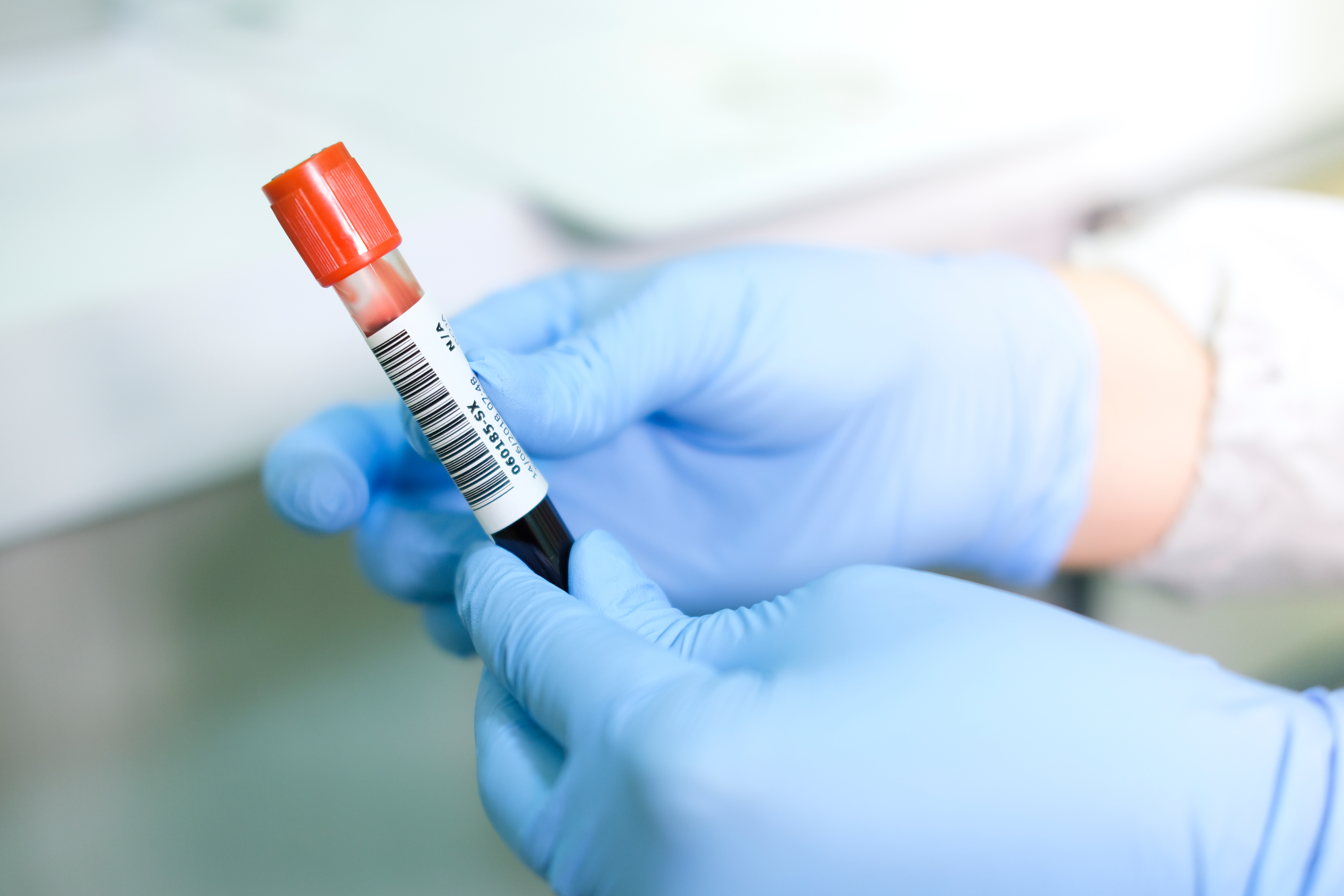 New blood test could detect Parkinson’s years before symptoms