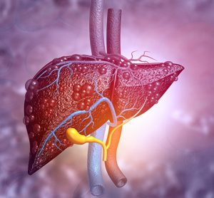 liver disease