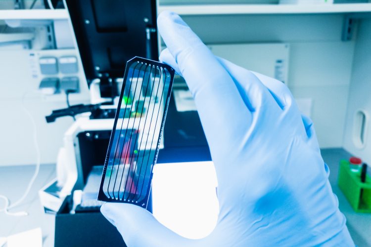 A gloved hand holding a next-generation sequencing flow cell in a bright laboratory setting with scientific equipment in the background.