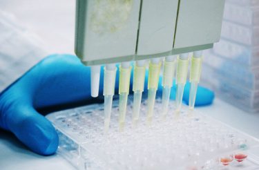 Pipettes held in blue gloved hand