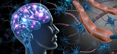 Illustration of a human brain and neurons with damaged and healthy myelin sheaths, representing multiple sclerosis and demyelination in the central nervous system.