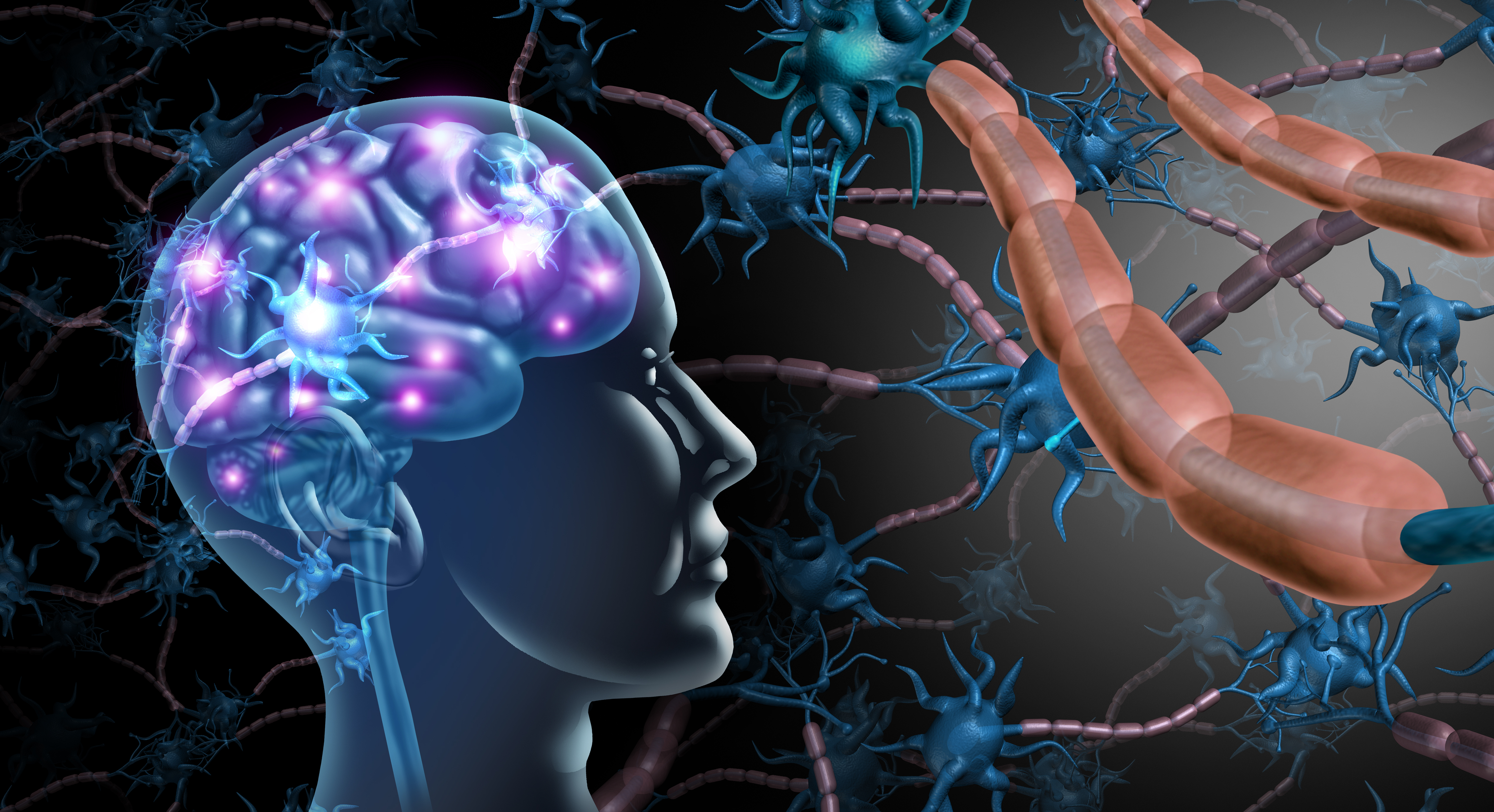 Illustration of a human brain and neurons with damaged and healthy myelin sheaths, representing multiple sclerosis and demyelination in the central nervous system.