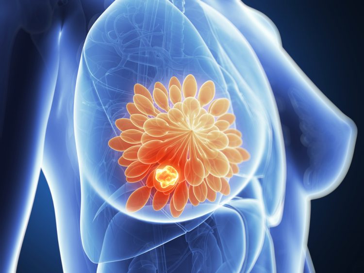 blue torso of a woman with a breast cancer tumour highlighted in glowing red