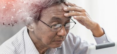 Man losing memory, indicating Alzheimer's
