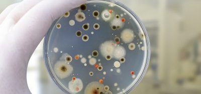 Bacteria and fungi