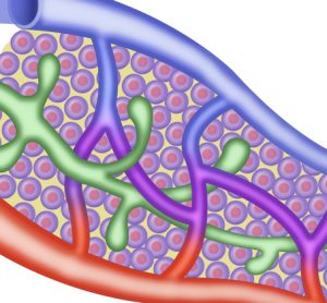 Study reveals how MRSA infection compromises lymphatic function