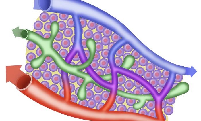 Study reveals how MRSA infection compromises lymphatic function