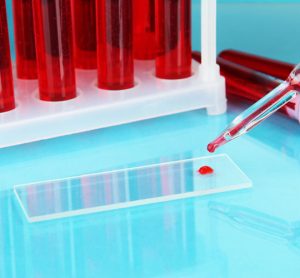 blood test