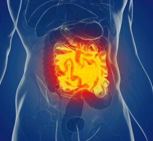 Blue model of abdomen with gut inflamed in orange