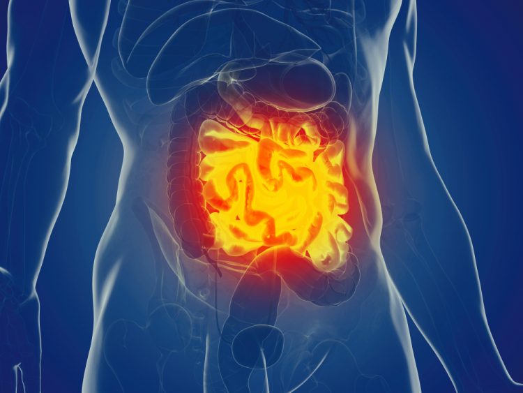 Blue model of abdomen with gut inflamed in orange