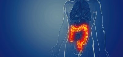 inflammatory bowel disease (IBD)