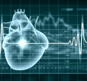 Cardiac imaging analysis